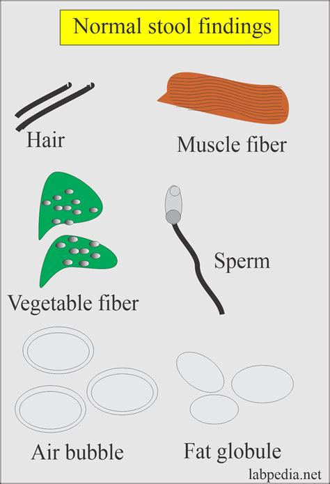 Stool Examination:- Part 1 - Normal Stool Examination Findings ...