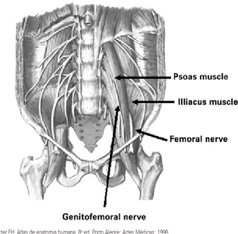 Figure 1 from Femoral nerve neuropathy after the psoas hitch procedure ...