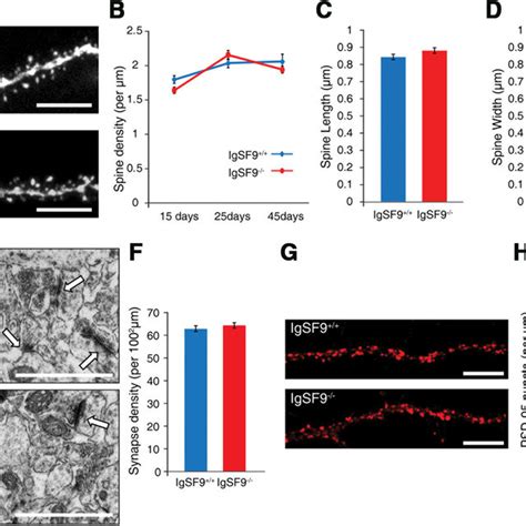 Normal spine and excitatory synapse development in the hippocampus of ...