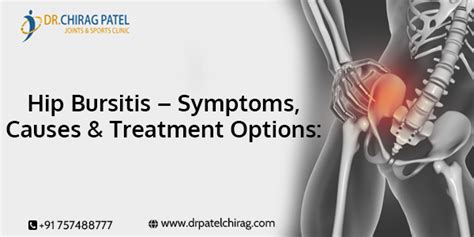 Hip Bursitis – Symptoms, Causes & Treatment Options: | Dr Chirag Patel