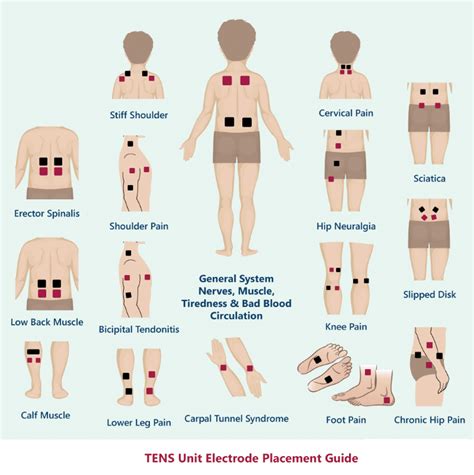 Tens 7000 Pad Placement Chart