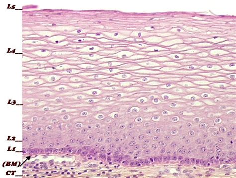 Histopathology of the uterine cervix - digital atlas