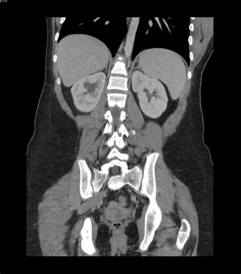 Abdominal And Pelvic Mri submited images.