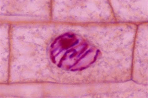 Interphase Mitosis Plant Cell