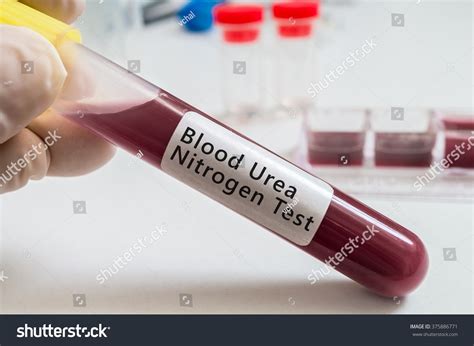 538 Blood urea Images, Stock Photos & Vectors | Shutterstock