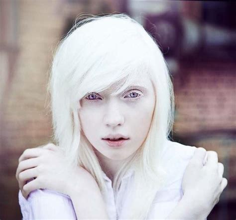 Would you ever date a albino person? - GirlsAskGuys