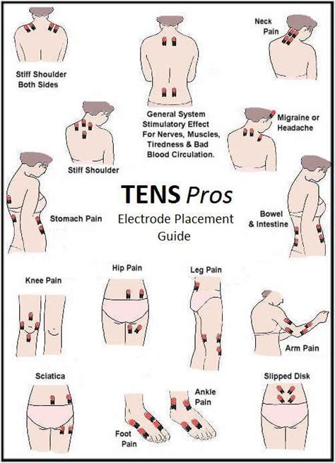 Tens Unit Placement Diagram