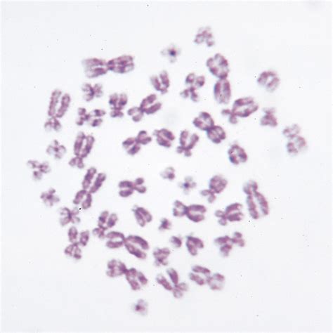 Human Male Chromosomes - 46, XY, spread Microscope Slide | Carolina ...