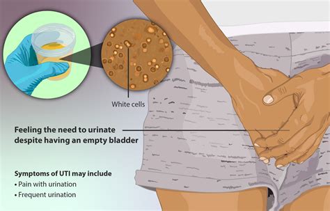 Urinary Tract Infection (UTI) Symptoms What It Feels Like, 50% OFF