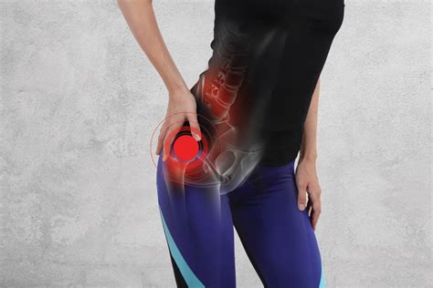 How to Identify Hip Arthritis: Check Symptoms and Signs – SAPNA Pain ...