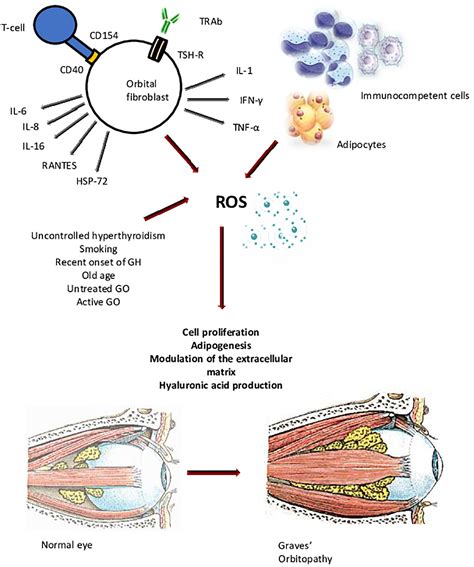 Frontiers | Antioxidant Therapy in Graves’ Orbitopathy