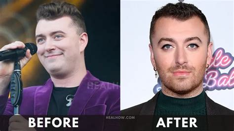 Sam Smith Weight Loss 2024: Before and After