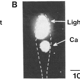 Aequorin luminescence elicited by light and by calcium injections . (A ...