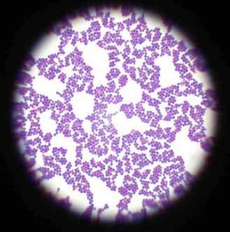 Staphylococcus Aureus Microscope