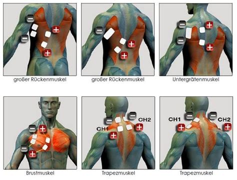 Ems Pad Placement Chart