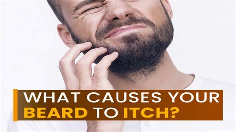 Itchy Beard: Causes And How To Treat It - Boldsky.com