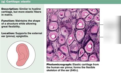 Elastic Cartilage Diagram | Quizlet