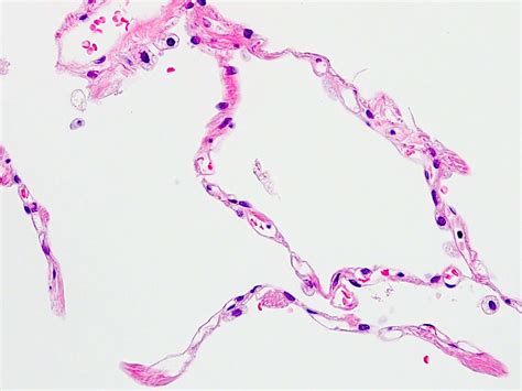 Lung Alveoli Histology