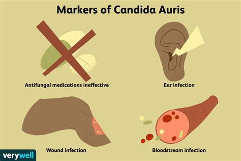 Candida Auris: Symptoms, Causes, Diagnosis, Treatment