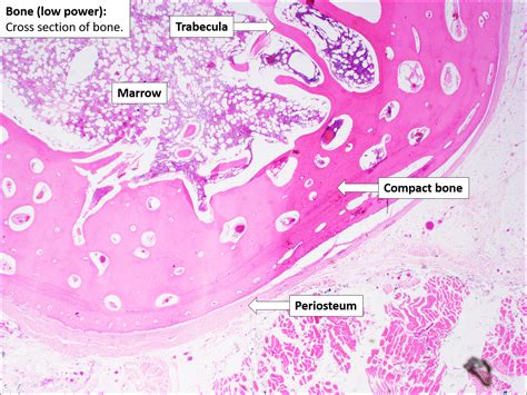 Bone – Normal Histology – NUS Pathweb :: NUS Pathweb