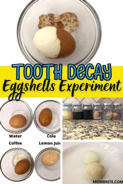 Tooth Decay Eggshells Experiment | Tooth decay, Decay, Experiments