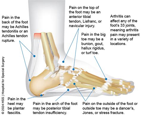 Pain On Top Of Foot Deals | www.aikicai.org