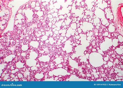 Histology Of Alveoli