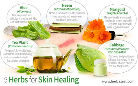 5 Herbs for Skin Healing | HerbaZest