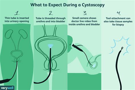 Cystoscopy: Uses, Side Effects, Procedure, Results