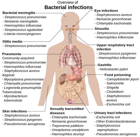 Overview of Bacterial Infections | Medical Laboratories