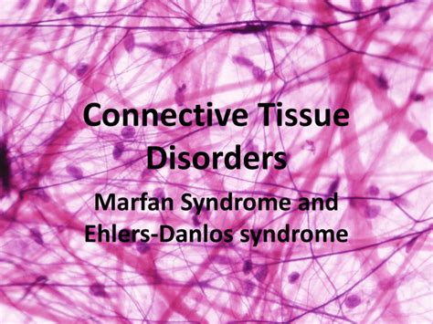 Connective Tissue Disorders