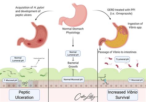 Gastric Acid Ph