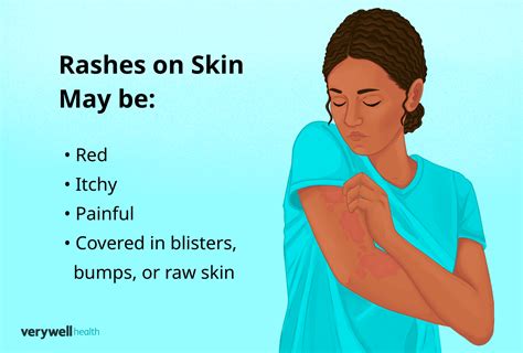 What Causes Rashes On Hands And Arms