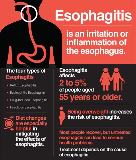 Esophagitis: Symptoms, Causes and Treatments – The Amino Company