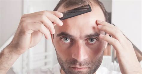 Frontal Fibrosing Alopecia: Understanding the Causes and Symptoms