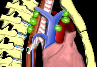 The Radiology Assistant : Mediastinal Lymph Node Map (2023)