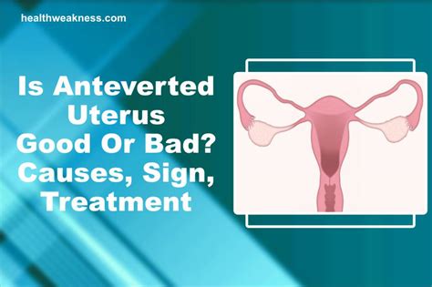 Is Anteverted Uterus Good Or Bad? Causes, Sign, Treatment (2025)