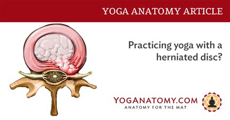 Practicing Yoga With A Herniated Disc? - Yoganatomy