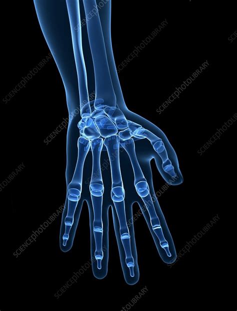 Human hand bones, artwork - Stock Image - F010/5795 - Science Photo Library