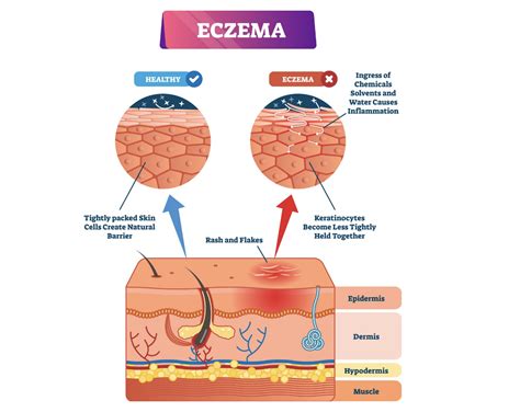 7 Causes of Itchy Skin [Pruritus]: Treatments for Rashes, Bumps & More ...