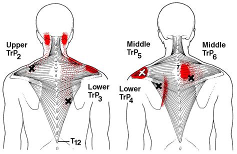 Back Muscle Pain Under Right Shoulder Blade Burning Pain Between Your ...