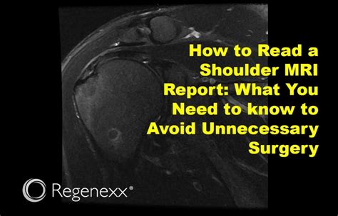 How to Read a Normal vs. Abnormal Shoulder MRI - Regenexx