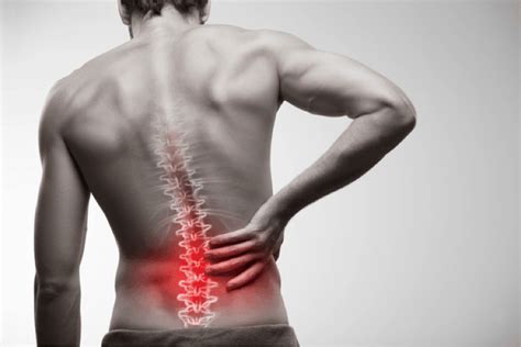 Understanding Lower Back Pain Causes | IMPACT Physical Therapy