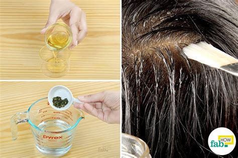 8 Best Home Remedies for Dry, Flaky Scalp That Work | Fab How