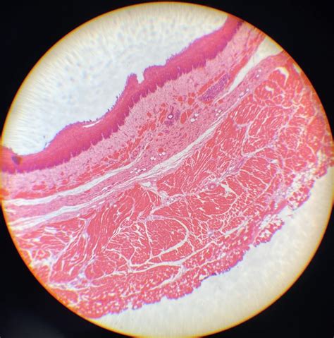 esophagus Diagram | Quizlet