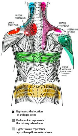 Knots & Trigger Points - The Massage Rebel