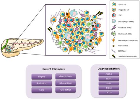 Stages Of Pancreatic Cancer