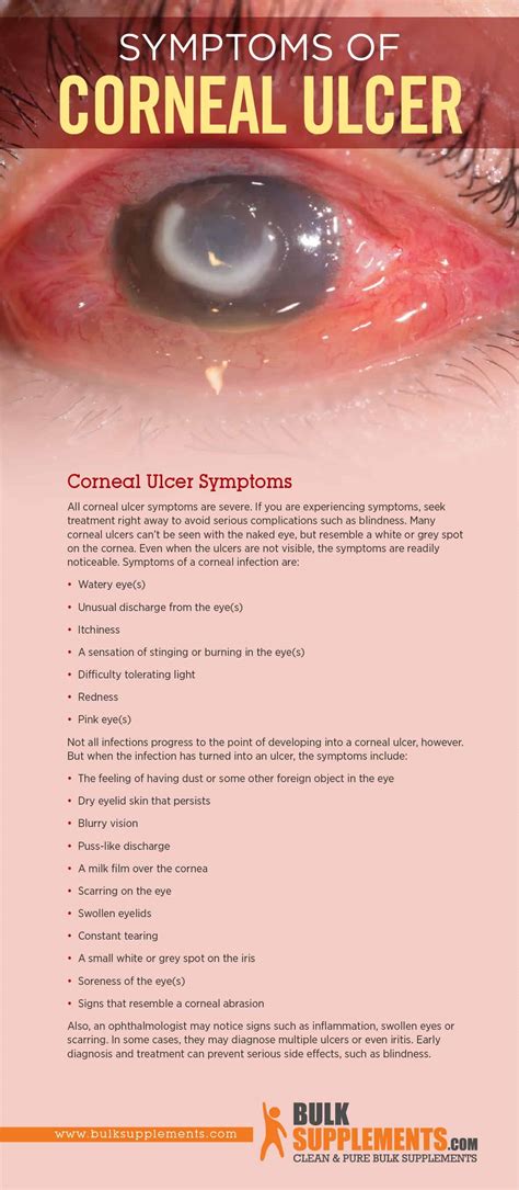 Corneal Ulcer: Characteristics, Causes & Treatment