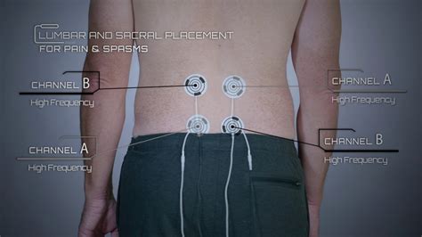 Tens Pads Placement For Sciatica Sale In | www.pinnaxis.com