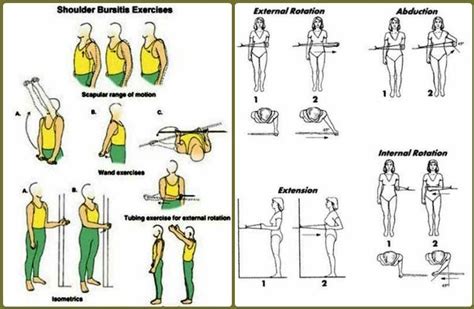 Shoulder Exercises for Bursitis - Mobile Physiotherapy Clinic